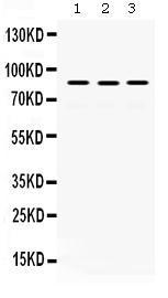 Anti-MLH1 Rabbit Polyclonal Antibody