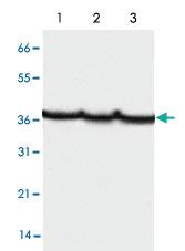 Anti-GAPDH Mouse Monoclonal Antibody