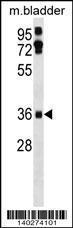 Anti-EI24 Rabbit Polyclonal Antibody (PE (Phycoerythrin))