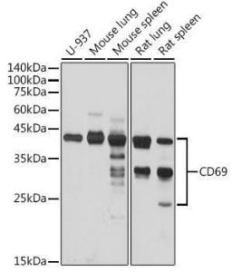 Western blot analysis of extracts of various cell lines, using Anti-CD69 Antibody (A11506) at 1:1,000 dilution