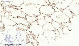 Immunohistochemical analysis of paraffin-embedded human lung tissue using Anti-STAT3 Antibody at 1:200 (4 °C overnight). Negative control was secondary antibody only