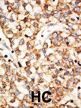 Anti-APOBEC1 Rabbit polyclonal antibody unconjugated