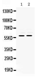 Anti-MMP8 Rabbit Polyclonal Antibody