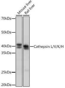 Western blot analysis of extracts of various cell lines, using Anti-Cathepsin L/V/K/H Antibody [ARC1276] (A305481) at 1:1,000 dilution The secondary antibody was Goat Anti-Rabbit IgG H&L Antibody (HRP) at 1:10,000 dilution Lysates/proteins were present at 25 µg per lane