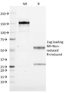 SDS-PAGE analysis of Anti-ZFYVE28 Antibody [LST2/2426] under non-reduced and reduced conditions; showing intact IgG and intact heavy and light chains, respectively SDS-PAGE analysis confirms the integrity and purity of the antibody