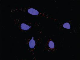 Anti-ATM Antibody Pair