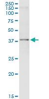 Anti-ARG1 Polyclonal Antibody Pair