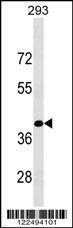 Anti-KLF15 Rabbit Polyclonal Antibody (AP (Alkaline Phosphatase))