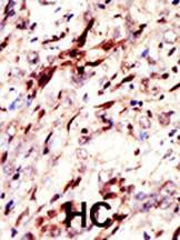 Anti-SUMO, Pan Rabbit Polyclonal Antibody