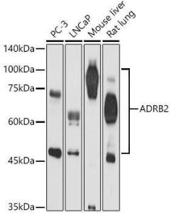 Western blot analysis of extracts of various cell lines, using Anti-beta 2 Adrenergic Receptor Antibody (A11507) at 1:500 dilution