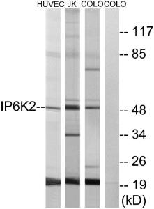 Anti-Inositol Hexakisphosphate Kinase 2 Rabbit Polyclonal Antibody