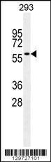 Anti-CCDC36 Rabbit Polyclonal Antibody (AP (Alkaline Phosphatase))