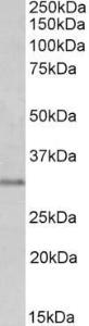 Anti-MSX1 Antibody (A84032) (0.3µg/ml) staining of Human Prostate lysate (35µg protein in RIPA buffer). Primary incubation was 1 hour. Detected by chemiluminescence.