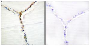 Immunohistochemical analysis of paraffin-embedded human thyroid gland using Anti-AhR (phospho Ser36) Antibody The right hand panel represents a negative control, where the antibody was pre-incubated with the immunising peptide