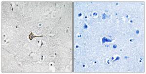 Immunohistochemical analysis of paraffin-embedded human brain tissue using Anti-KCND2 Antibody. The right hand panel represents a negative control, where the antibody was pre-incubated with the immunising peptide.