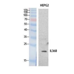 Anti-IL36 beta Rabbit Polyclonal Antibody