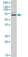 Anti-GTF3C5 Mouse Polyclonal Antibody