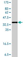 Anti-EXOSC2 Mouse Polyclonal Antibody