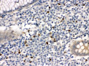 Anti-MMP8 Rabbit Polyclonal Antibody