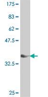 Anti-FBXL5 Mouse Polyclonal Antibody