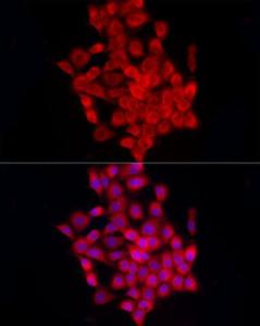 Immunofluorescence analysis of A-431 cells using Anti-beta 2 Adrenergic Receptor Antibody (A11507) at a dilution of 1:100 (40X lens). DAPI was used to stain the cell nuclei (blue)