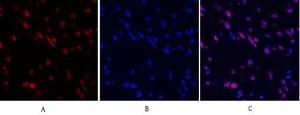 Immunofluorescence analysis of human uterus tissue using Anti-STAT3 Antibody (red) at 1:200 (4 °C overnight). Cy3 labelled secondary antibody was used at 1:300 (RT 50min). Panel A: Target. Panel B: DAPI. Panel C: Merge