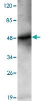 Anti-GSK3B Mouse Monoclonal Antibody