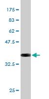 Anti-PTN Mouse Monoclonal Antibody [clone: 5C3]