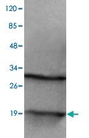 Anti-H2AFZ Mouse Monoclonal Antibody