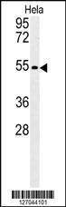 Anti-KLF17 Rabbit Polyclonal Antibody (AP (Alkaline Phosphatase))