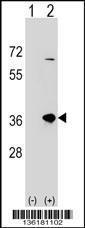 Anti-SULT1B1 Rabbit Polyclonal Antibody (AP (Alkaline Phosphatase))