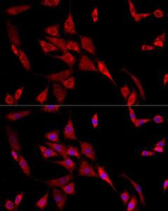 Immunofluorescence analysis of NIH/3T3 cells using Anti-beta 2 Adrenergic Receptor Antibody (A11507) at a dilution of 1:100 (40X lens). DAPI was used to stain the cell nuclei (blue)