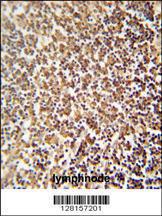 Anti-ZNF98 Rabbit Polyclonal Antibody (Biotin)