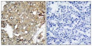 Antibody anti-STAT1 A95777-100 100 µg