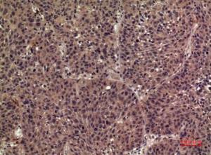 Anti-IL36 beta Rabbit Polyclonal Antibody