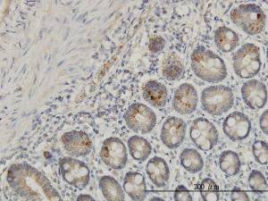 Anti-IL37 Mouse Monoclonal Antibody [clone: 6A6]