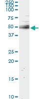 Anti-UBASH3A Mouse Monoclonal Antibody [clone: 4D2]