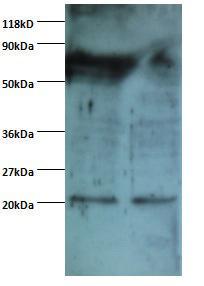 Anti-ARF4 Rabbit Polyclonal Antibody