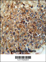 Anti-CD46 Rabbit Polyclonal Antibody