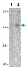 Anti-ORAI1 Mouse Monoclonal Antibody [clone: 6D11A11]