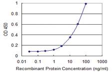 Anti-UBASH3A Mouse Monoclonal Antibody [clone: 4D2]