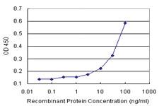 Anti-GLMN Antibody Pair