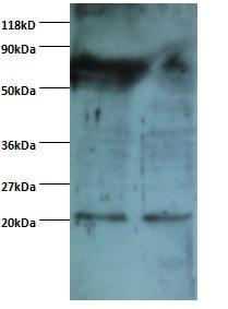 Anti-ARF4 Rabbit Polyclonal Antibody (Biotin)