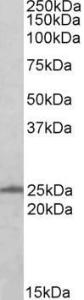 Anti-RAN Antibody (A84035) (0.5 µg/ml) staining of A431 (35 µg protein in RIPA buffer). Primary incubation was 1 hour. Detected by chemilu minescence