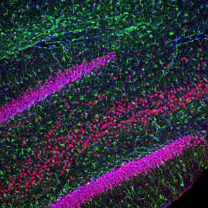 Immunofluorescent analysis of rat hippocampus section stained with Anti-TARBDP Antibody (1:2,000/red) and Anti-GFAP Antibody (A85307/1:5,000/green)