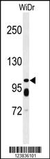 Anti-ABCC11 Rabbit Polyclonal Antibody