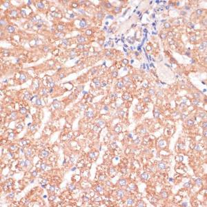 Immunohistochemistry analysis of paraffin-embedded rat liver using Anti-IKK alpha Antibody (A11508) at a dilution of 1:100 (40x lens) Perform microwave antigen retrieval with 10 mM PBS buffer pH 72 before commencing with IHC staining protocol