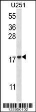 Anti-EIF1AY Rabbit Polyclonal Antibody