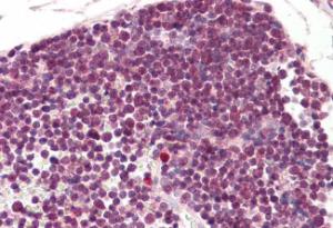 Anti-RAN Antibody (A84035) (3.75 µg/ml) staining of paraffin embedded Human Thymus. Steamed antigen retrieval with citrate buffer pH 6, AP-staining