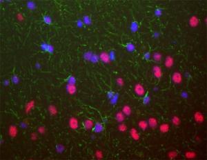 Anti-TARBDP Antibody was used to stain a section of formalin fixed adult rat brain, specifically the hippocampus